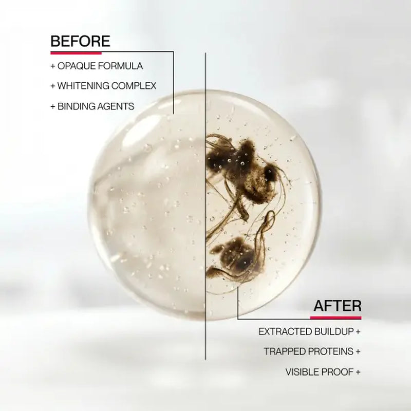 Hismile Id Stain Whitening Mouthwash for White Teeth, Freshens Breath with Essential Oils 237Ml